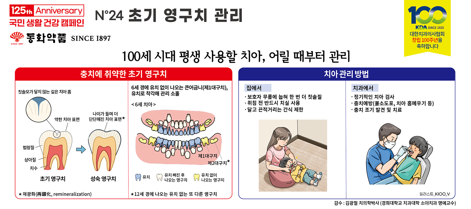 초기 영구치 관리